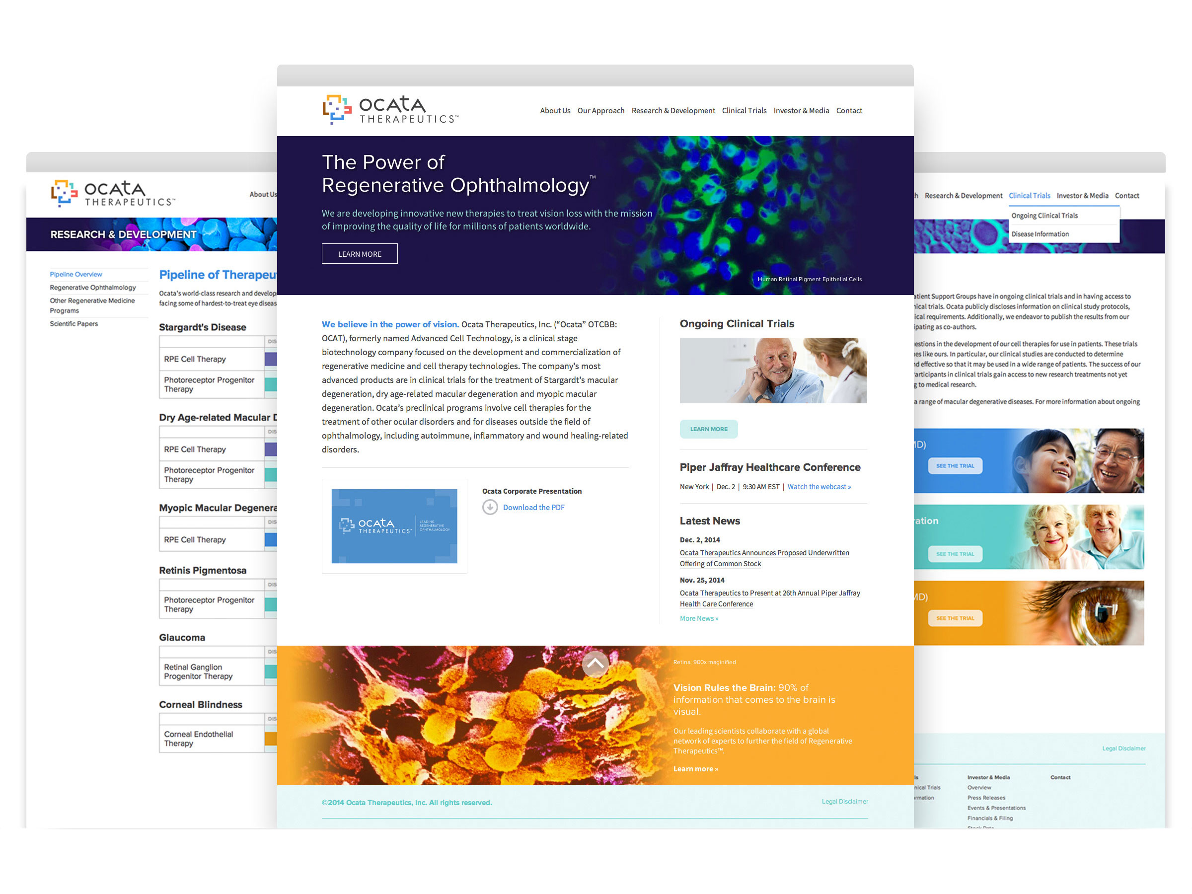 Ocata Therapeutics website interior pages